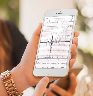 Bluetooth Transfer Ecg Ambulatory Monitoring With Smart Iphone ECG D Evice