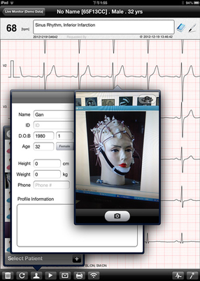 iPad ECG Machine 12 Lead Electrocardiography For Heart Rate Monitor