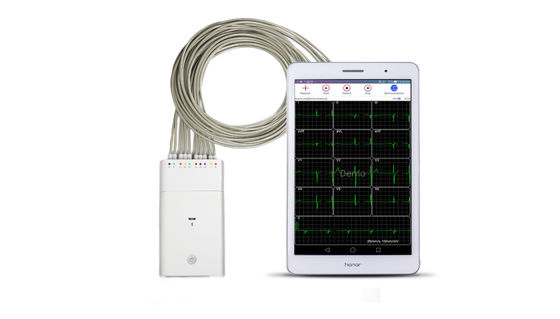 De witte ECG-Machine van het Systeembluetooth ECG van Andriod van het Signaalregistreertoestel